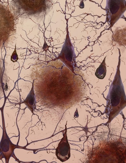 Damaged Neurons